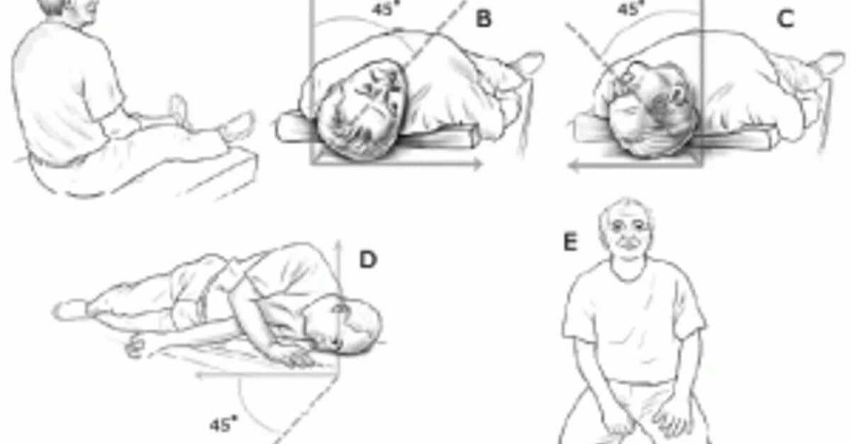 Маневры Эпли при головокружении. Маневр Брандта-Дароффа. Упражнение Эпли при головокружении. Вестибулярная гимнастика ДППГ.