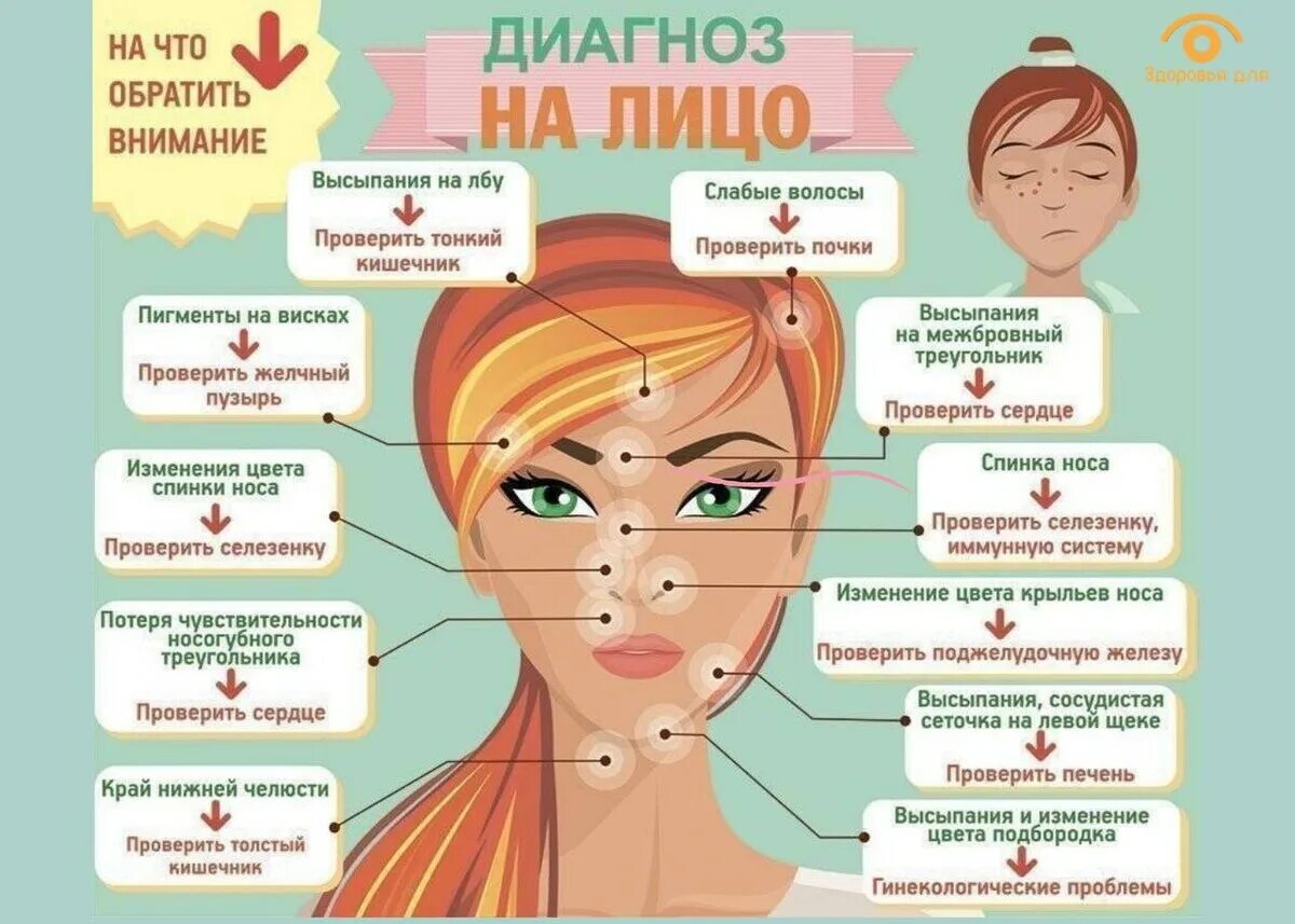 Что значат прыщи на лбу у девушки. Прыщи на лице причины по зонам у женщин. прыщи на лице по зонам причины. схема прыщей на лице.