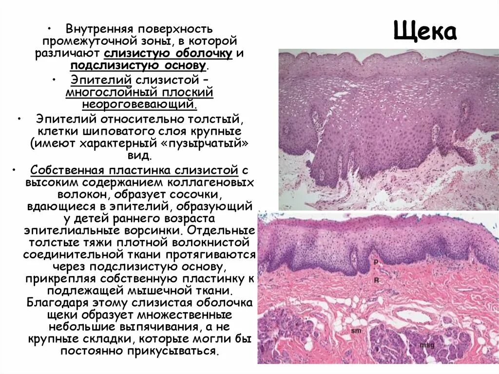 Люнд слизистой оболочки. Многослойный плоский эпителий слизистой оболочки полости рта. Неороговевающий слой эпителий полости рта. Эпителий слизистой рта. Эпителий слизистой оболочки рта.