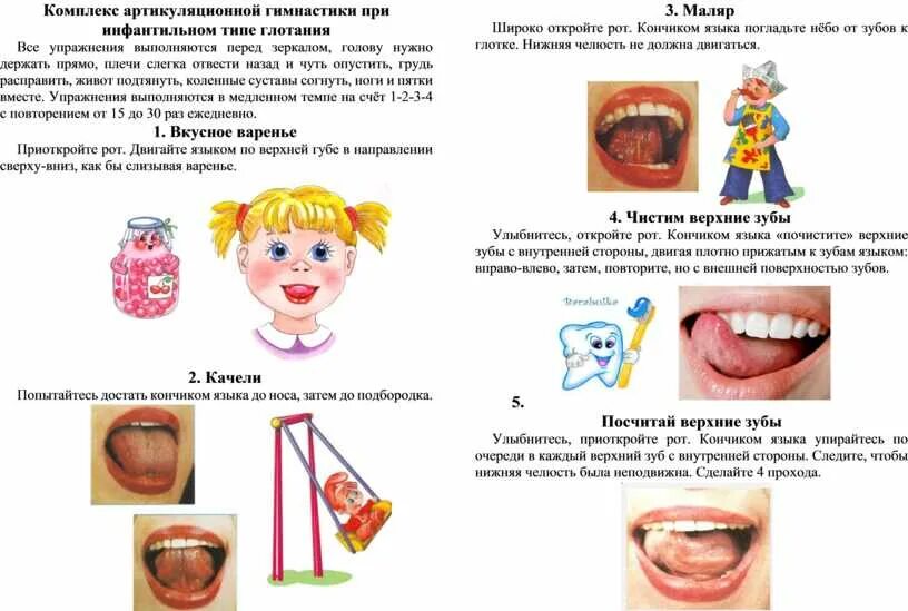 Артикуляционной моторики у детей. Упражнения для тренировки артикуляционного аппарата. Комплекс артикуляционных упражнений при инфантильном типе глотания. Артикуляционная гимнастика при инфантильном типе глотания. Артикуляционная гимнастика для звуков верхнего подъема.