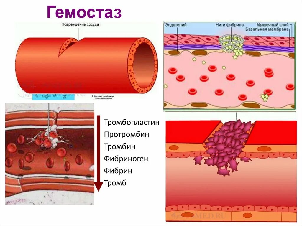 Гемостаз. Гемостаз картинки. Тромб нити