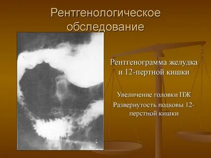 Папиллит