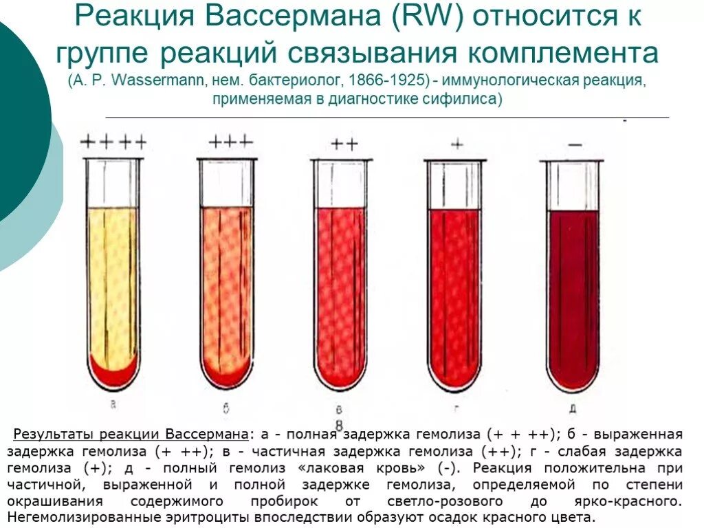 Реакция микропреципитации Вассермана. Полный гемолиз в РСК. Гемолиз эритроцитов в пробирке. Реакция гемолиза микробиология.