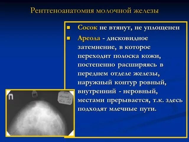 Нормальная рентгеноанатомия молочной железы. Маммография очаговая асимметрия. Анатомия молочной железы рентген. Маммография презентация. Маммография периодичность