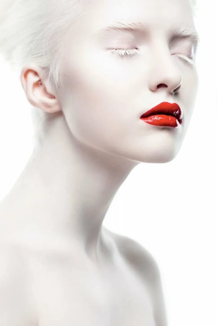 Как стать белым лицом. Настя жидкова альбинос. Отбеливание кожи. Как стать белым лицом. Осветленные брови.