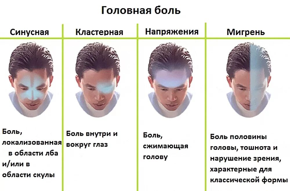 Сильный прилив крови к голове. Типы головной боли по локализации. Головная боль локализация. Причины головной боли. Локализация головной боли и причины.