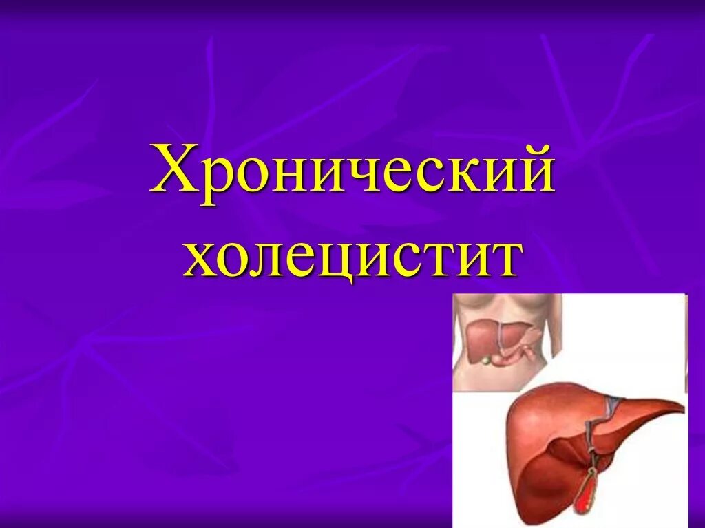 3 хронические холециститы