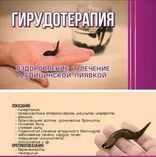 Пиявки медицинские пермь