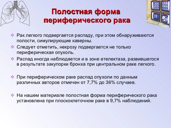 Полостное образование в легком. Полостные образования в легких на кт. 14. Полостные образования в легких. Клиника и диагностика. 1. Полостные образования в легких