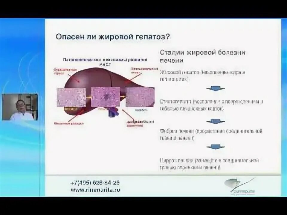 Чем опасна жировая печень. Жировой гепатоз капельницы. Гепатоз капельница гепатозе. Северные народы и гепатоз. Жировой гепатоз печени лечение капельницы.