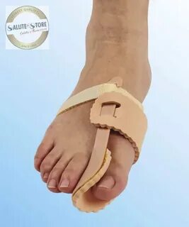 Hallux valgus что это такое