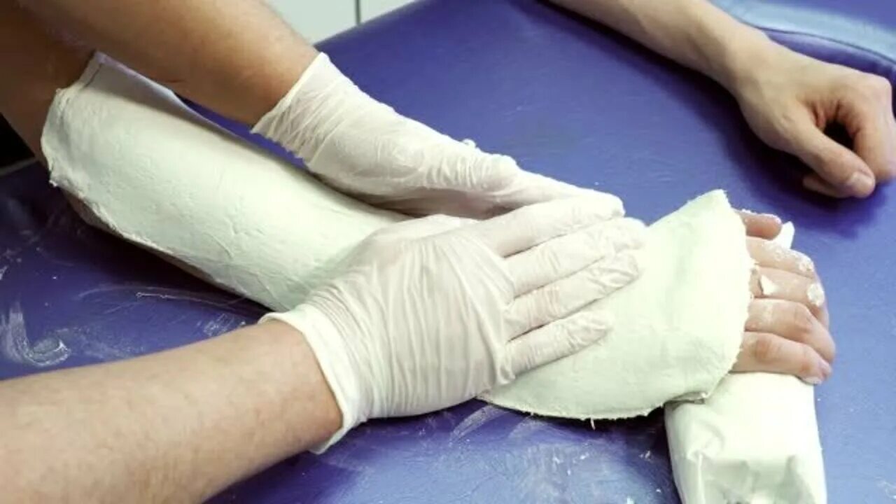 Сдавление конечности гипсовой повязкой. Почему гипс холодный. Почему гипс холодный. Почему гипс холодный. Почему гипс холодный.