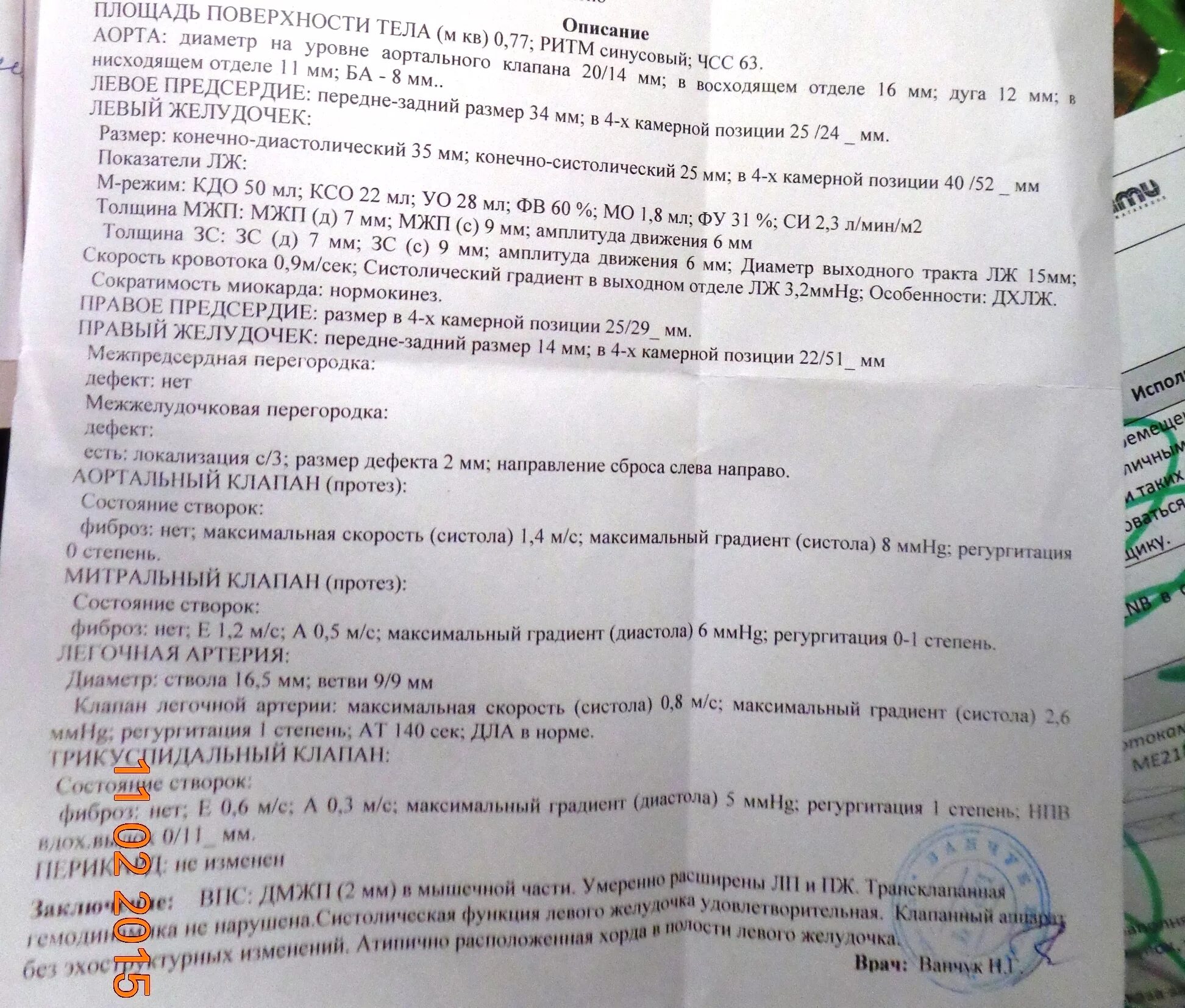 Эхо-кг сердца заключение норма. Узи сердца показатели нормы. Протокол эхокардиографии. Узи сердца показатели нормы. Узи сердца у детей нормы таблицы.