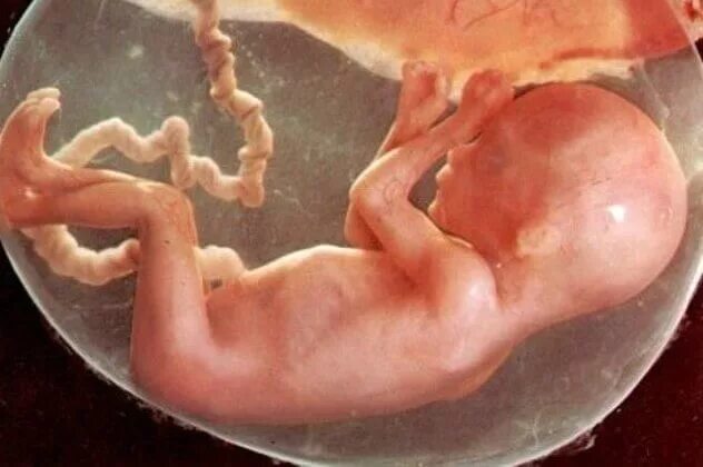 Как выглядит плод 20 недель фото Desarrollo Fetal (a partir de la 8 ° va semana) YouTube