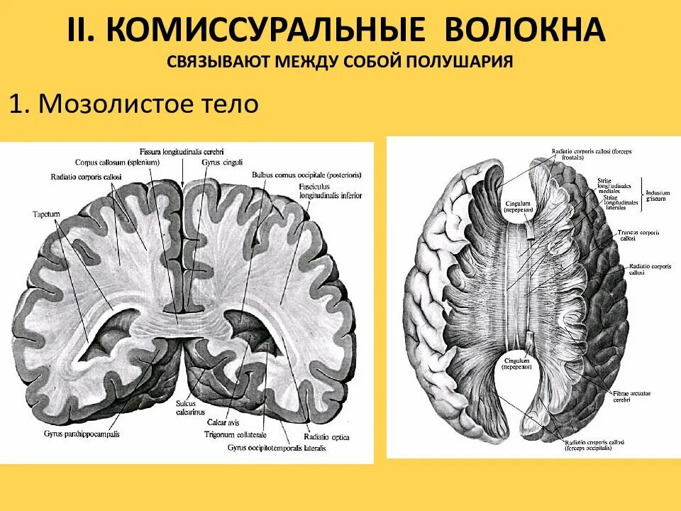 Полушария соединяет между собой. Волокна белого вещества ассоциативные комиссуральные. Комиссуральные волокна мозолистого тела. Белое вещество мозга комиссуральные волокна. Мозолистое тело белое вещество.