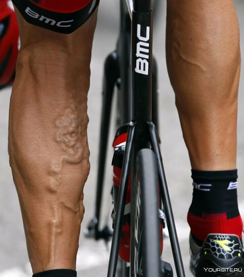Ноги велосипедистов тур де Франс. Ноги велогонщика тур де Франс. Ноги велосипедиста после тур де Франс. Болят колени после велосипеда