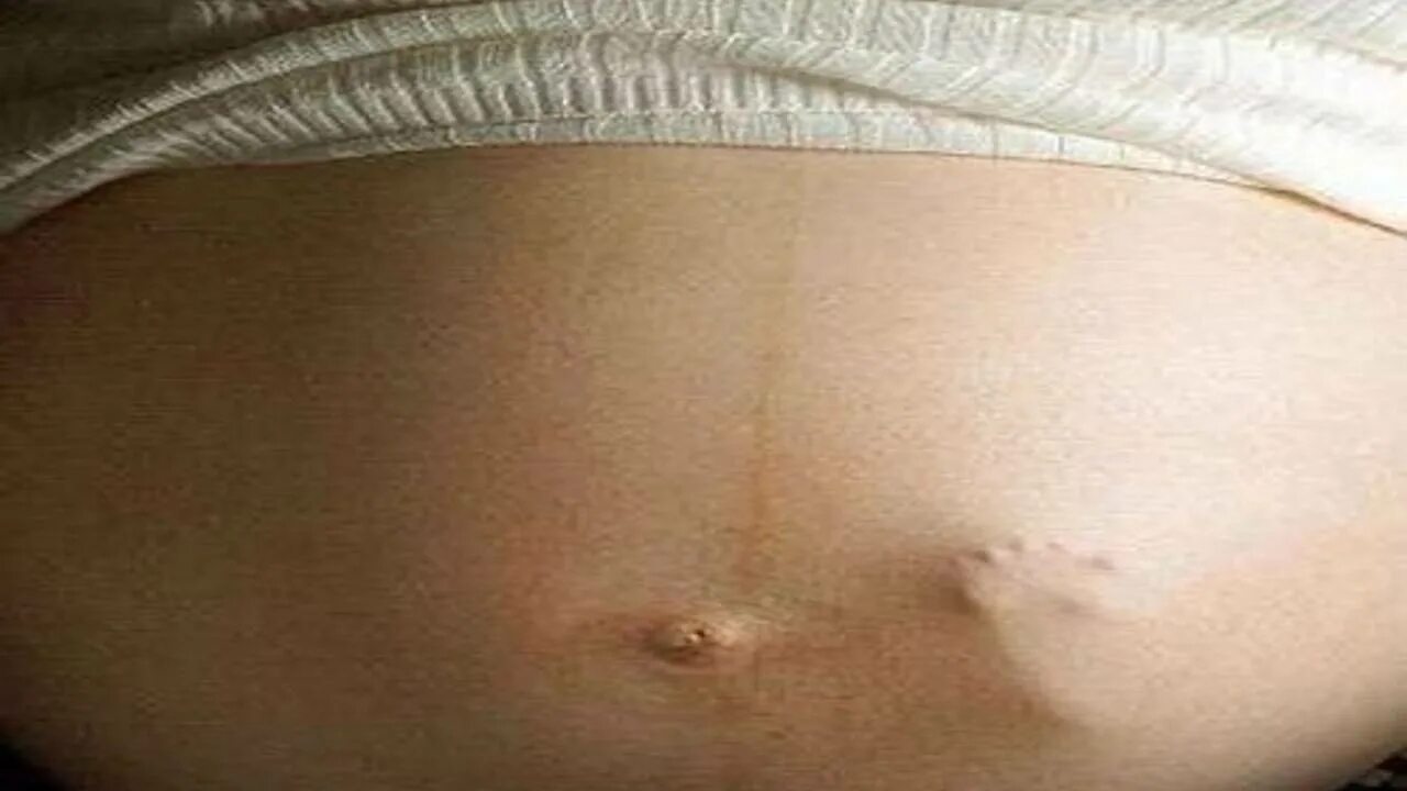 Шевеления ребёнка в животе. Ребенок в животе беременной.