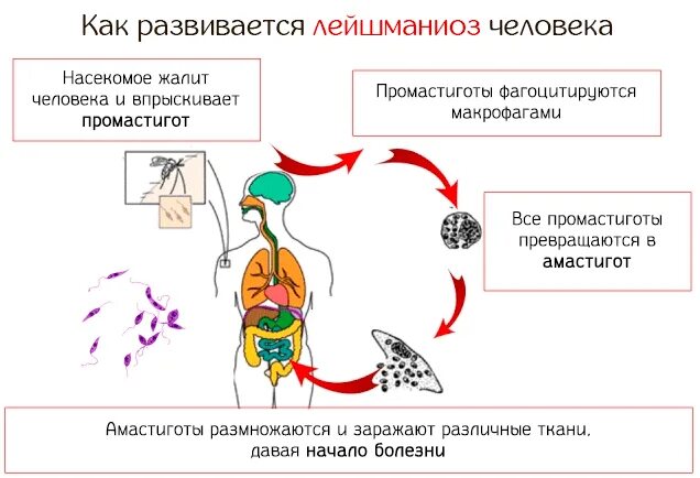 Пути заражения лейшмании. Способ заражения лейшмании. Лейшмания висцеральная пути заражения человека. Методы профилактики висцерального лейшманиоза.