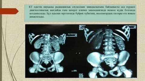 Аға әпке сағатының ішін аяқтады