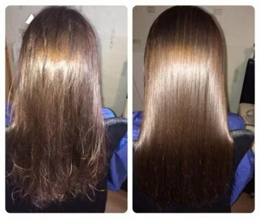 Ботокс кончиков