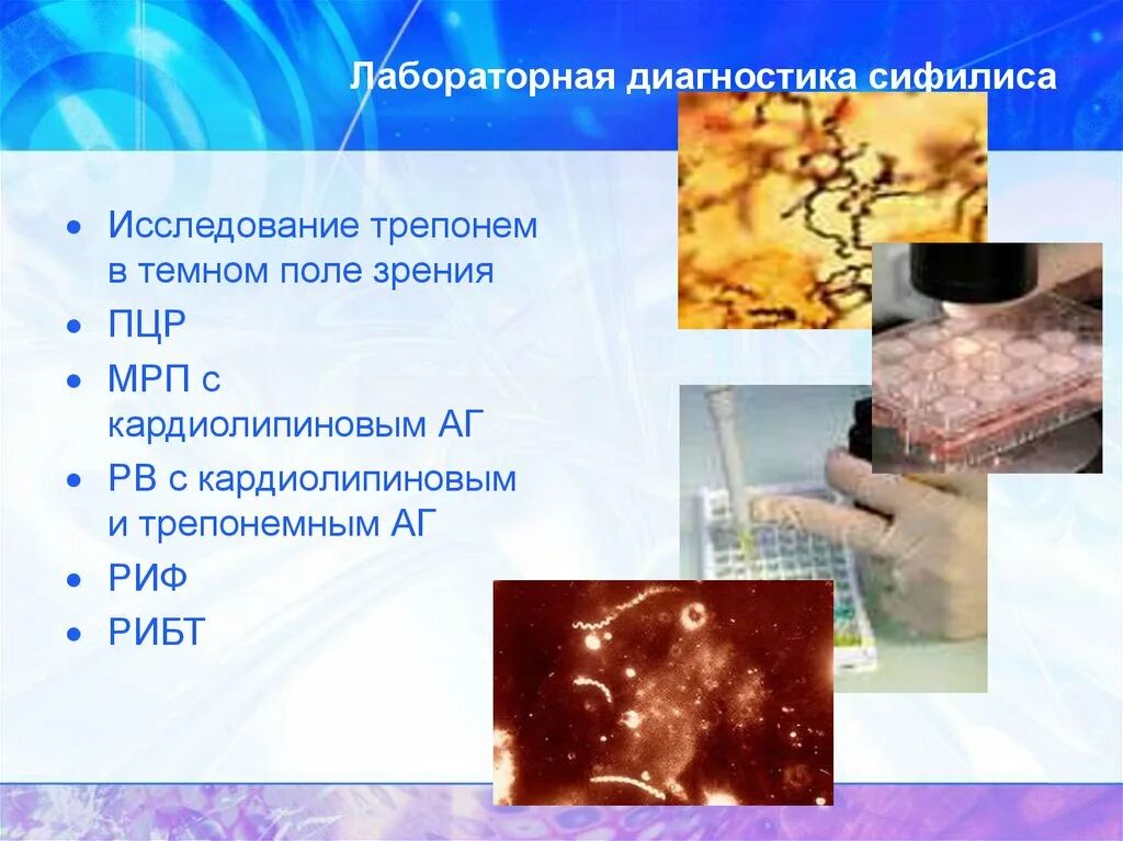 Диагностика трепонемы. Лабораторные исследования при первичном сифилисе. Бледная трепонема морфология. Сифилис лептоспироз микробиология. Трепонема микроскопия.