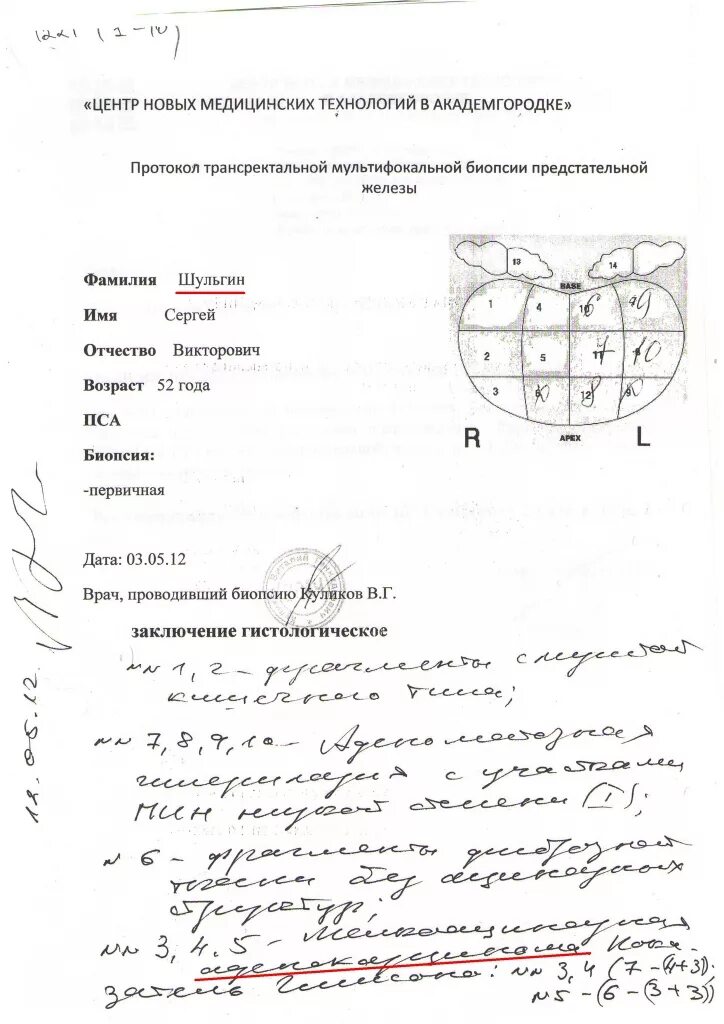 Протокол биопсии предстательной железы. Биопсия простаты заключение. Расшифровка биопсии предстательной железы. Результаты биопсии простаты расшифровка.