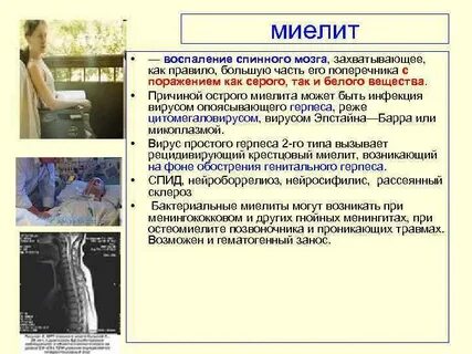 Воспаление спинного