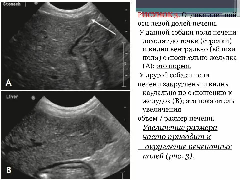 Что значит печень неоднородная. Образования печени на УЗИ. Образование левой доли печени. Очаговые образования в печени на УЗИ.