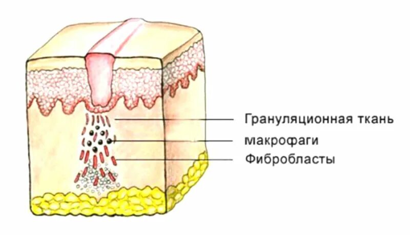 Раны и раневой процесс, лечение ран