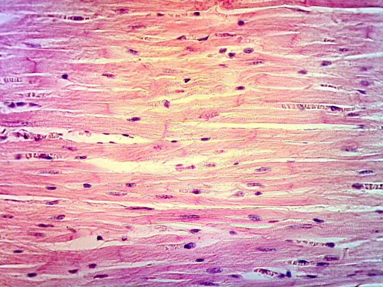 Гладкие мышцы многоядерные. Гладкая мышечная ткань гистология. Гладкомышечные клетки гистология. Поперечно полосатая мышечная ткань гистология. Гладкая мускулатура гистология.