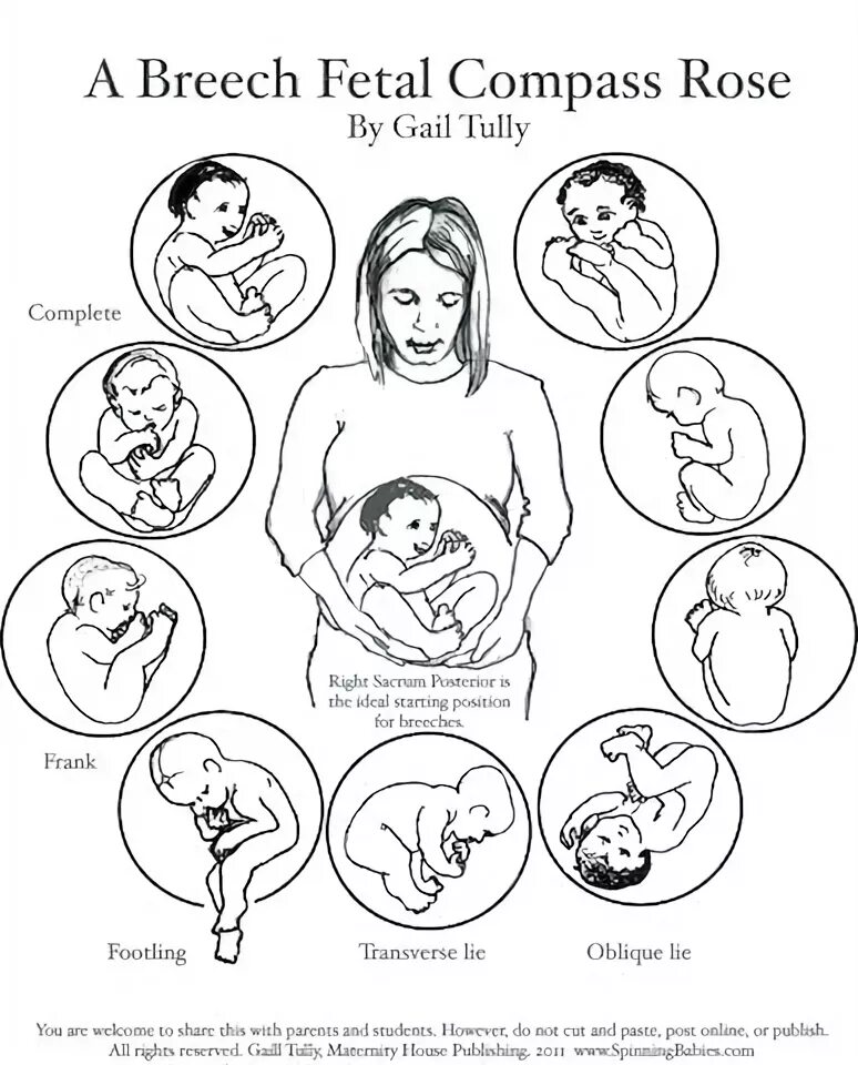 Belly Mapping Breech - How to tell if baby is breech - Spinning Babies Breech ba