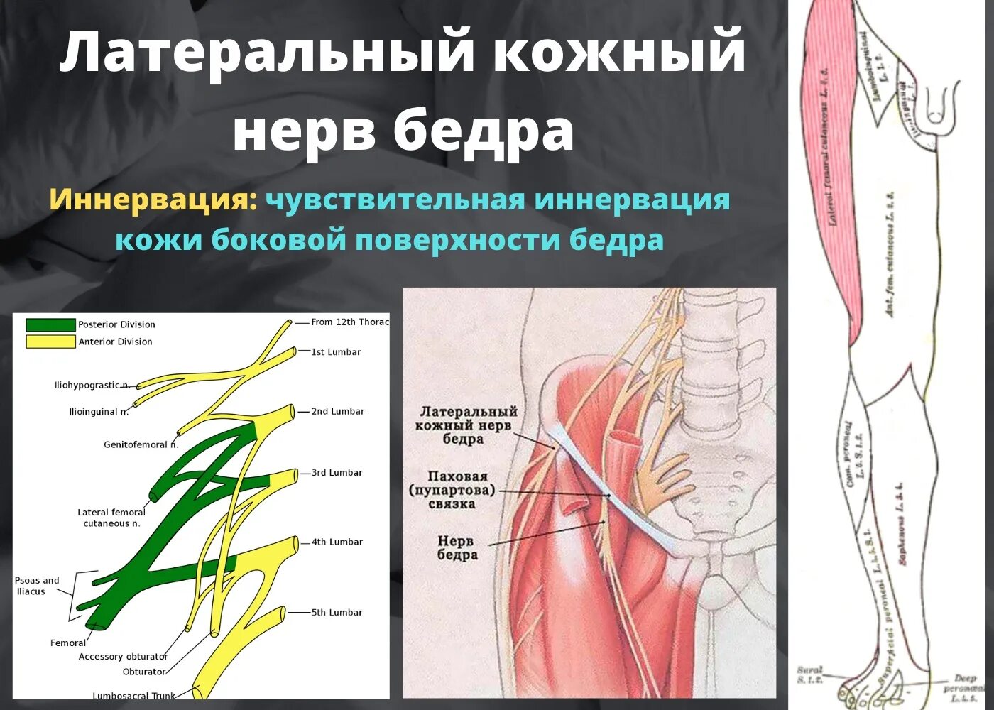 Невропатия наружного кожного нерва. Латеральный бедренный кожный нерв. Латеральный нерв бедра. Латеральный кожный нерв бедра.