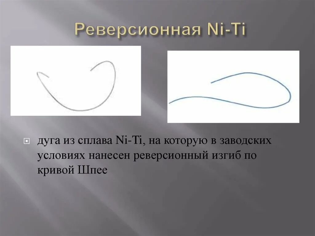 Реверсионная дуга. Реверсионные дуги ортодонтия. Реверс дуга ортодонтия. Реверсивная дуга в ортодонтии. Изгиб кривой