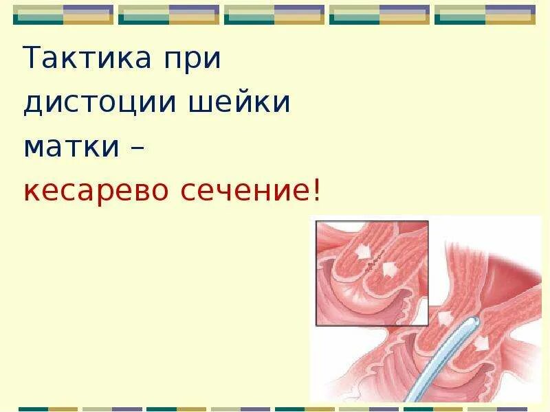 Старый разрыв шейки матки. Разрыв шейки матки клинические рекомендации.