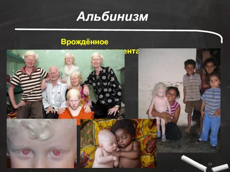 Альбинизм генетика. Альбинизм хромосомная мутация. альбинизм наследственное заболевание. альбинизм генная мутация.