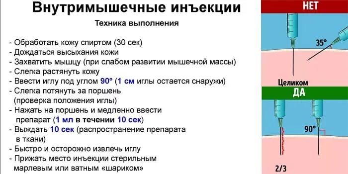 В какое время суток лучше колоть уколы. Техника выполнения инъекций внутримышечно. Игла для внутримышечных инъекций вводится. Методика введения внутримышечных инъекций. Введение внутримышечной инъекции.