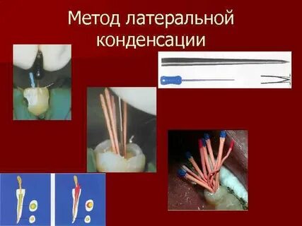 Мастер штифт