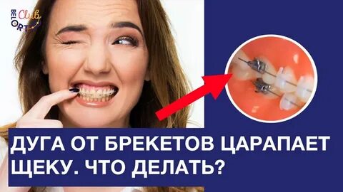 Что делать если вылетел брекет