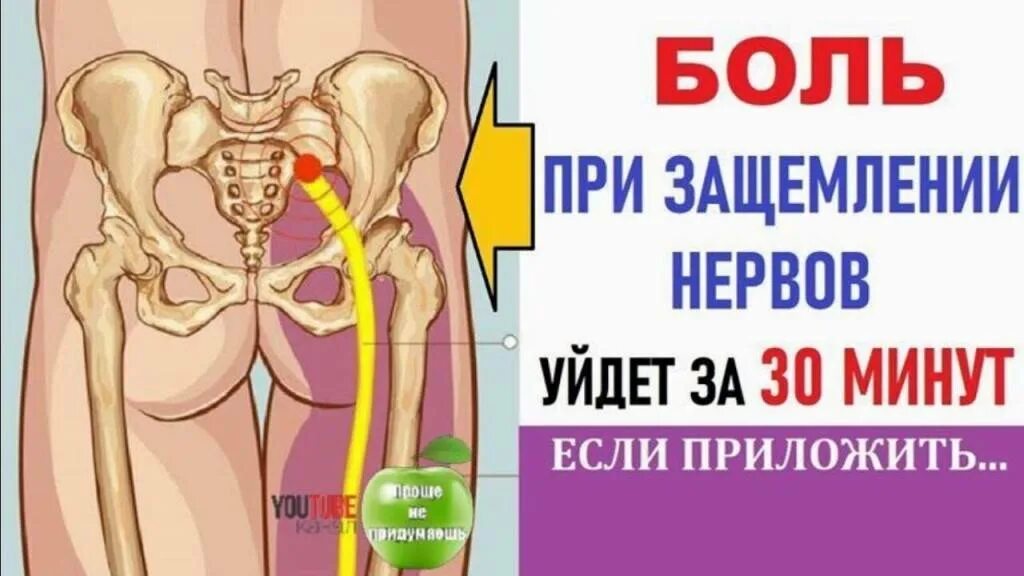 Какое лечение при защемлении