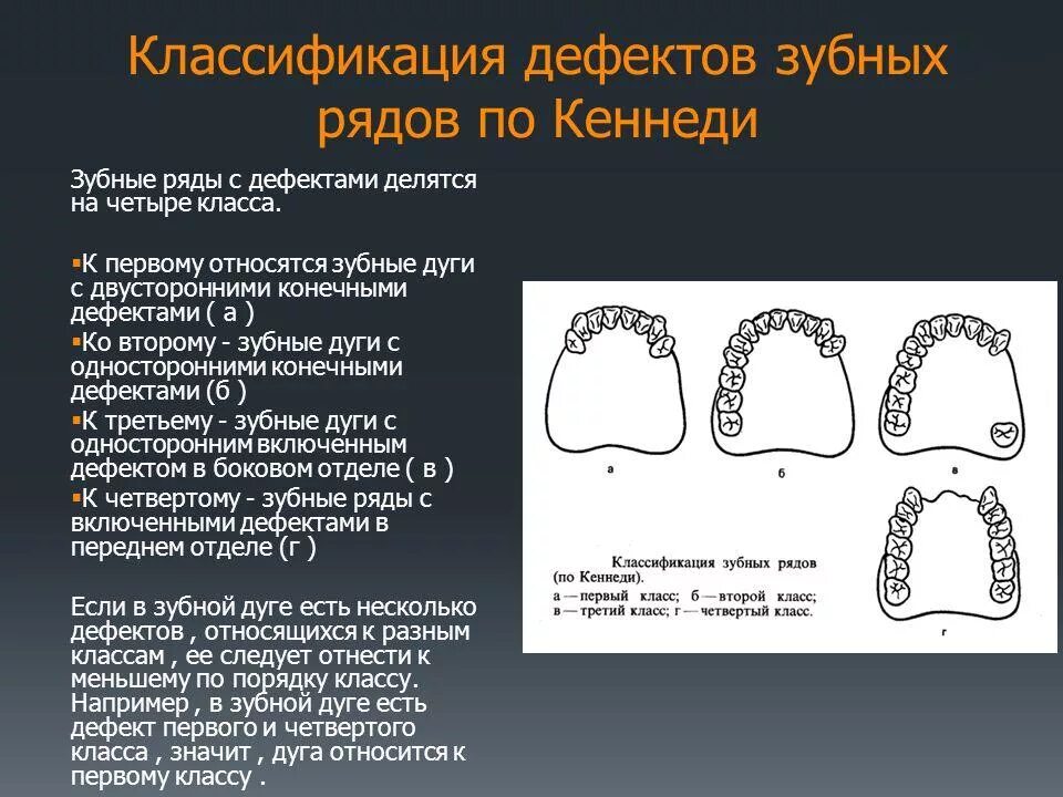 Классификация поражений зубов