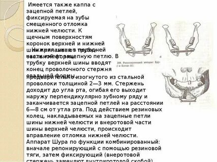 2 группа пациентов с переломом нижней челюсти