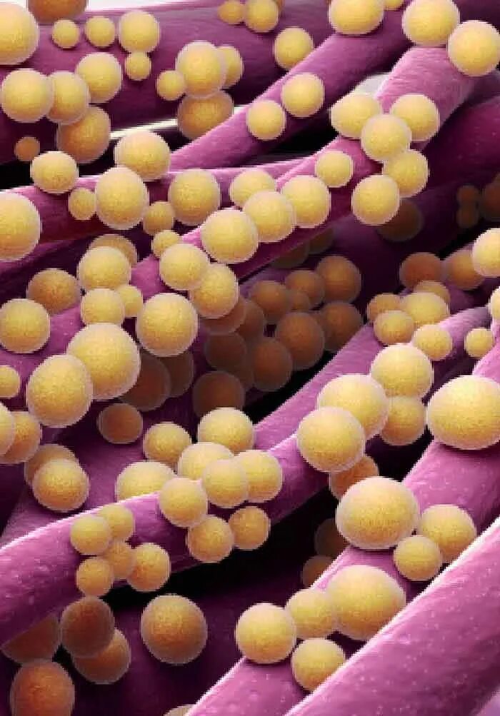 Staphylococcus aureus золотистый стафилококк. Метициллин-резистентный золотистый стафилококк. Бактерия стафилококк ауреус.