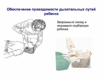 Нарушение проходимости верхних дыхательных путей