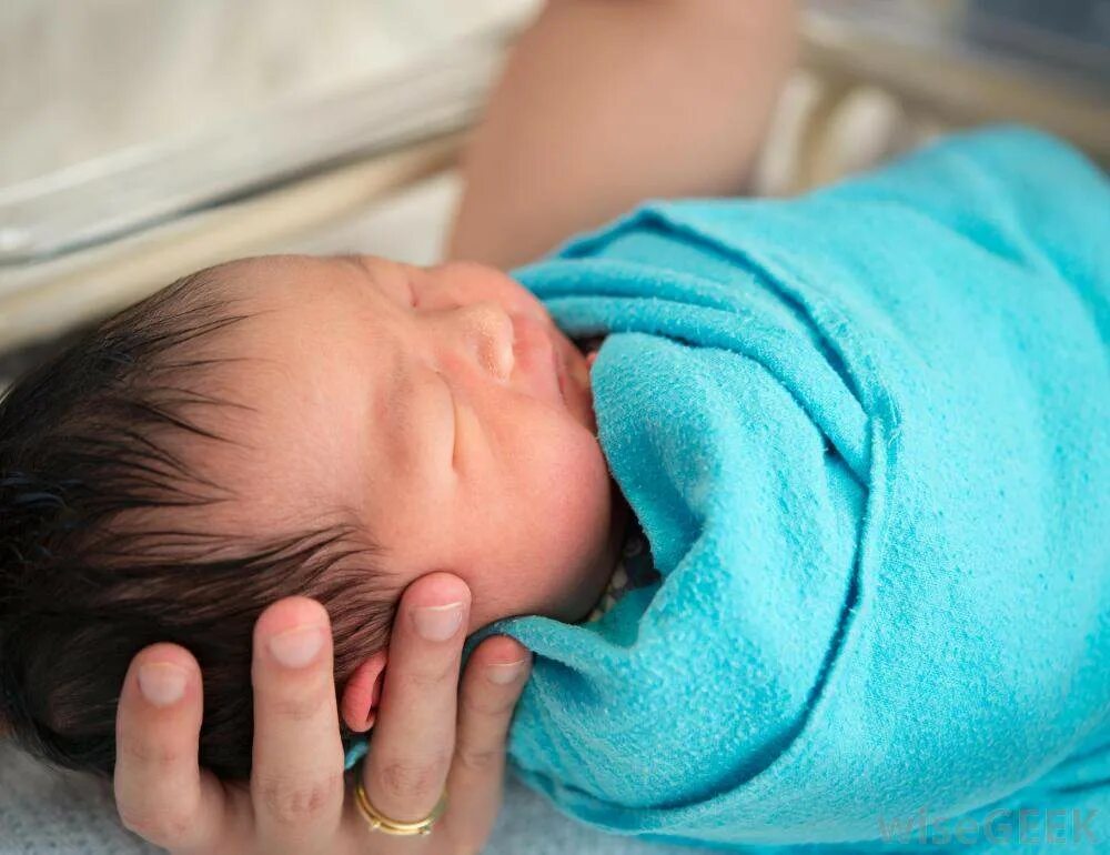 желтушка у новорожденных. новорожденные фото. галактоземия у новорожденных. новорожденные фото. кряхтит новорожденный.