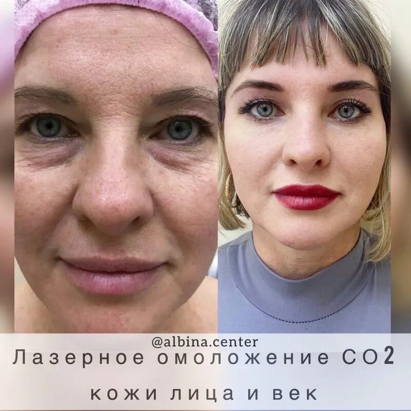 центр альбины самойловой в орле. альбина самойлова орел. центр альбины самойловой. салон альбины самойловой орел. альбина самойлова косметолог.