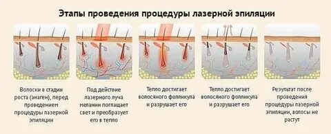 Солярий после лазера