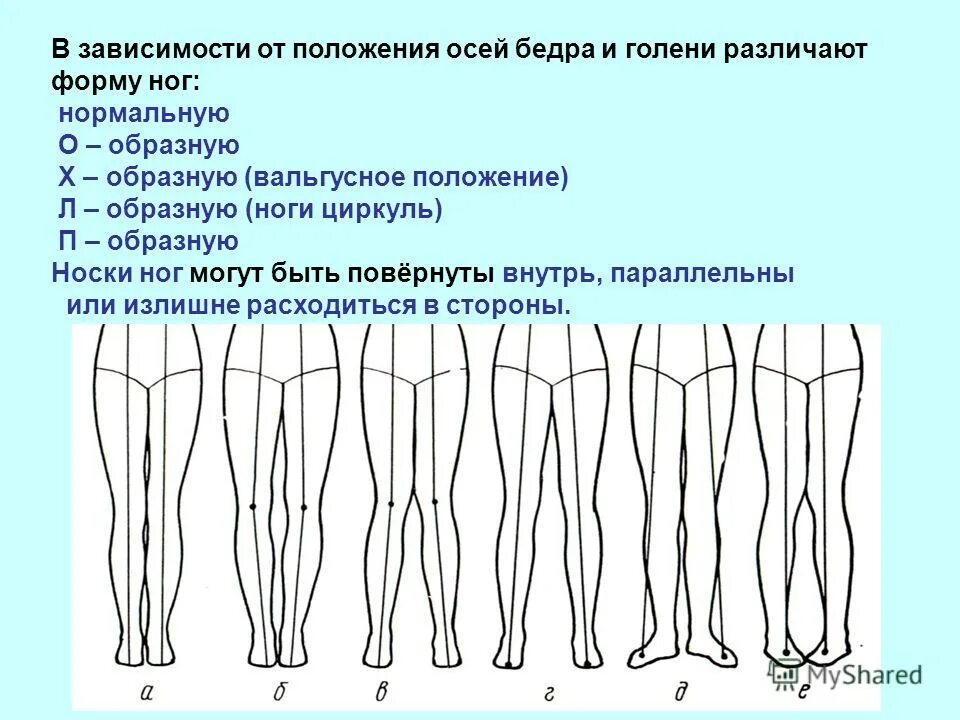 Какие должны быть ноги. Форма ног. Типы строения ног. Форма ног виды. Правильное строение ног.