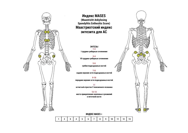 Mases индекс. Mases индекс энтезиты. Маастрихтский индекс энтезита.