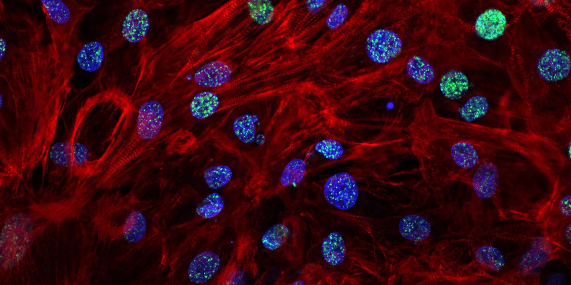 1 стволовые клетки. Плюрипотентные стволовые клетки гистология. Стволовые клетки микрофотография. Прогениторные клетки это стволовые клетки. Кроветворные стволовые клетки 3d.