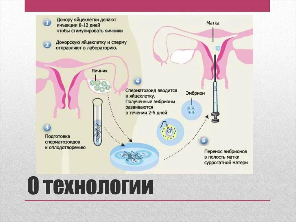 Продать яйцеклетку. Продать яйцеклетку